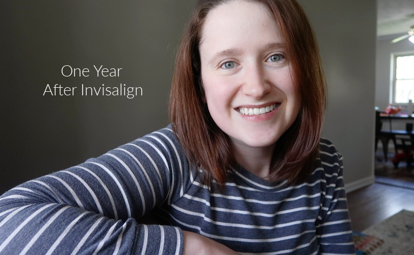 One Year Invisalign 3 Thoughts One Year After Invisalign Treatment - Retainers & Schedules